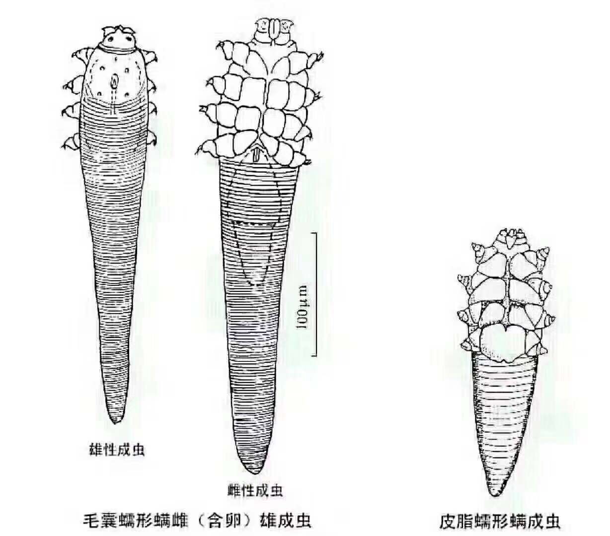 蕾特恩专业祛痘南外店告诉你们什么是螨虫